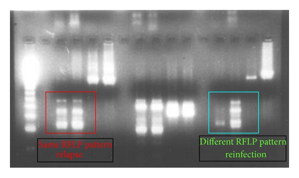 Antirelapse Efficacy of Various Primaquine Regimens for Plasmodium vivax.