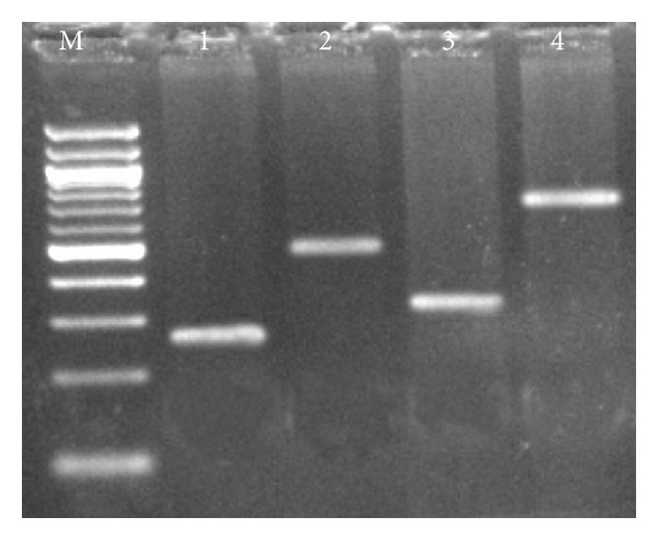 Identification and Validation of Expressed Sequence Tags from Pigeonpea (Cajanus cajan L.) Root.