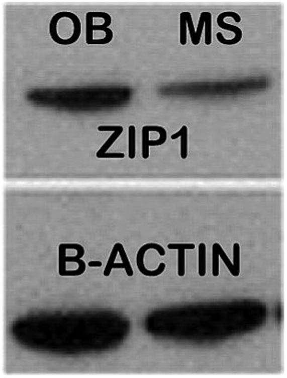 Evidence that Osteoblasts are Specialized Citrate-producing Cells that Provide the Citrate for Incorporation into the Structure of Bone.