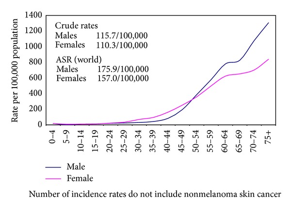 Cancer incidence in egypt: results of the national population-based cancer registry program.