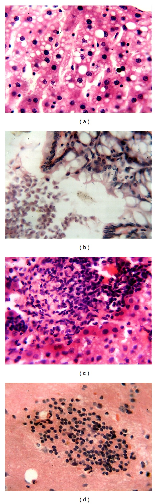 Pathology of Experimental Encephalitozoon cuniculi Infection in Immunocompetent and Immunosuppressed Mice in Iraq.