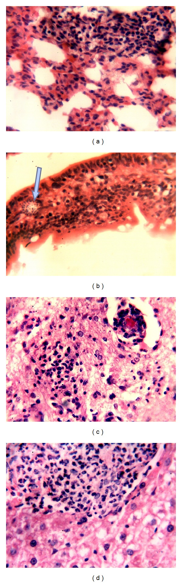 Pathology of Experimental Encephalitozoon cuniculi Infection in Immunocompetent and Immunosuppressed Mice in Iraq.