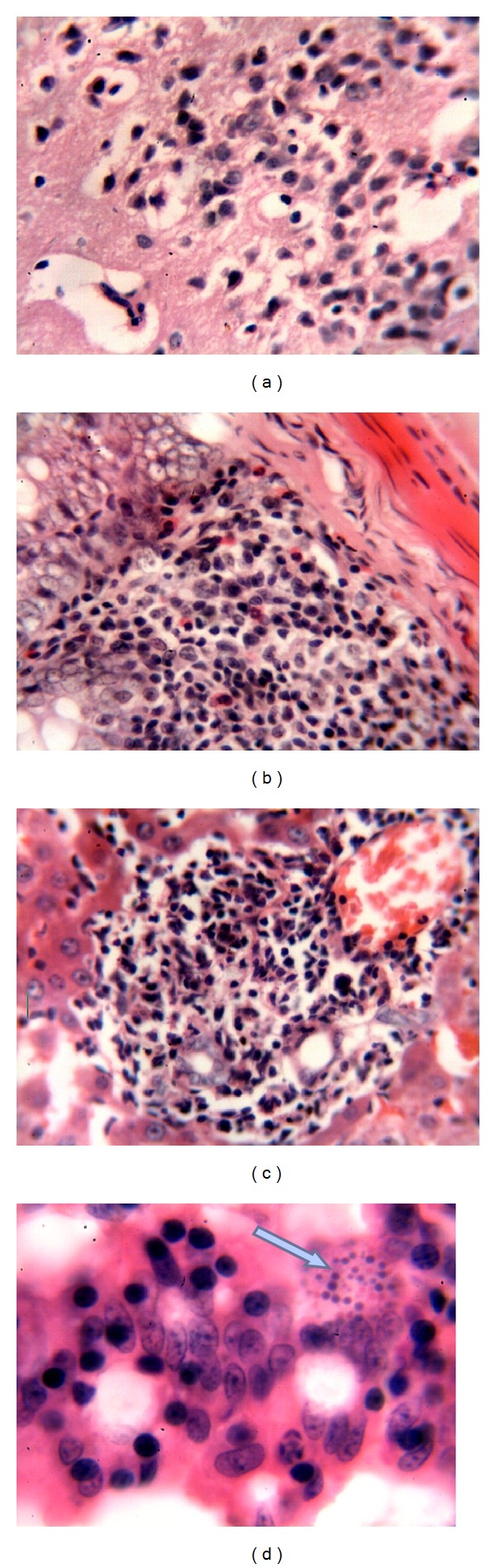 Pathology of Experimental Encephalitozoon cuniculi Infection in Immunocompetent and Immunosuppressed Mice in Iraq.