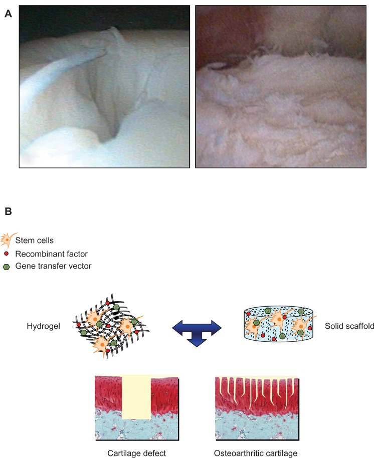 Current perspectives in stem cell research for knee cartilage repair.