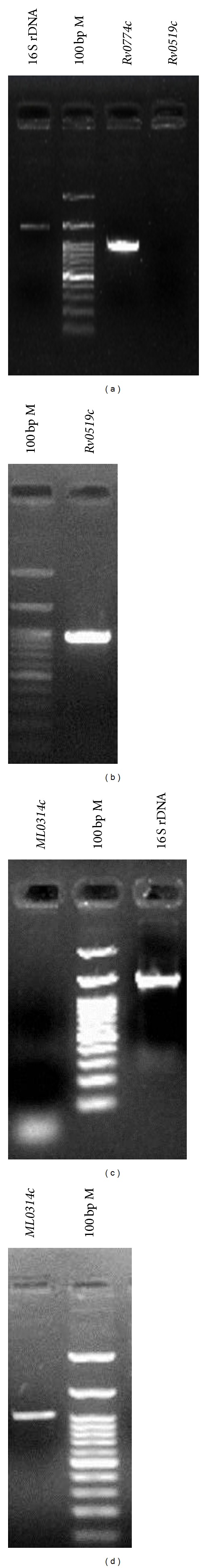 Primer Based Approach for PCR Amplification of High GC Content Gene: Mycobacterium Gene as a Model.