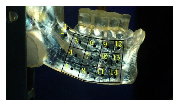 Photoelastic and finite element analyses of occlusal loads in mandibular body.