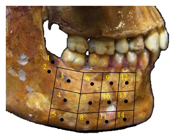 Photoelastic and finite element analyses of occlusal loads in mandibular body.