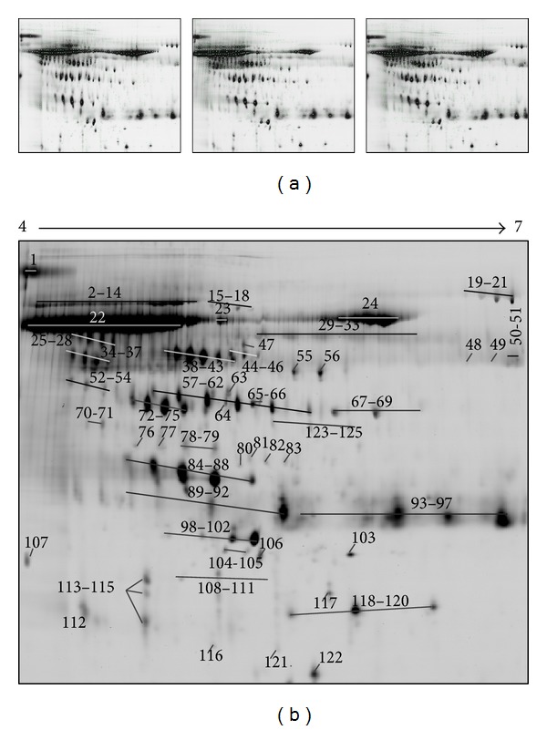 Mapping and Identification of the Urine Proteome of Prostate Cancer Patients by 2D PAGE/MS.