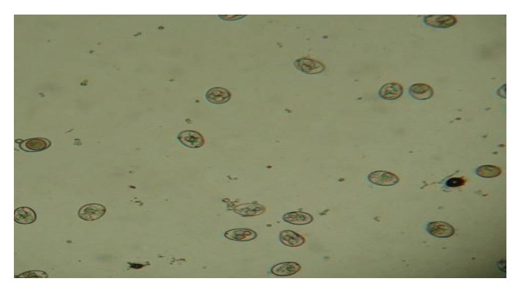 Experimental Infection with Sporulated Oocysts of Eimeria maxima (Apicomplexa: Eimeriidae) in Broiler.