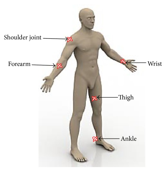 Surgical implications of asymmetric distribution of dermal collagen and elastic fibres in two orientations of skin samples from extremities.