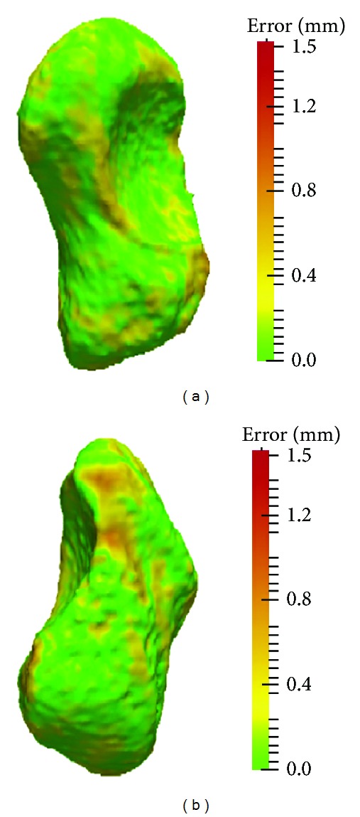 Quantification of contralateral differences of the scaphoid: a comparison of bone geometry in three dimensions.