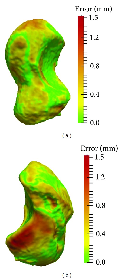Quantification of contralateral differences of the scaphoid: a comparison of bone geometry in three dimensions.