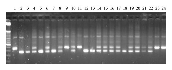 A tandem repeat in decay accelerating factor 1 is associated with severity of murine mercury-induced autoimmunity.