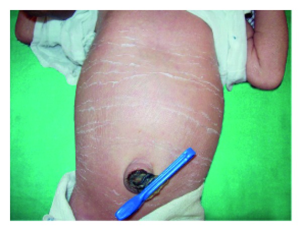 A cross-sectional prospective study of cutaneous lesions in newborn.