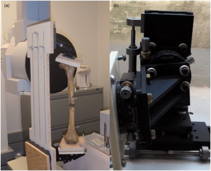 3D atlas-based registration can calculate malalignment of femoral shaft fractures in six degrees of freedom.