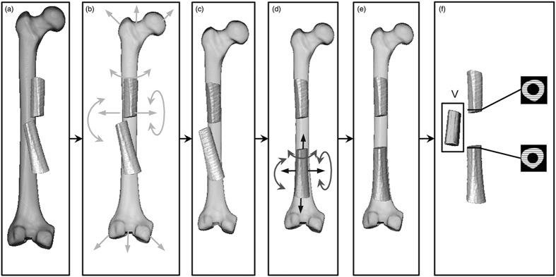 3D atlas-based registration can calculate malalignment of femoral shaft fractures in six degrees of freedom.