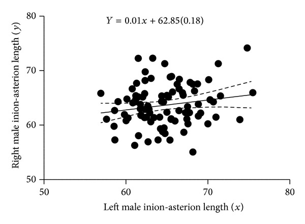 Sex Determination Using Inion-Opistocranium-Asterion (IOA) Triangle in Nigerians' Skulls.