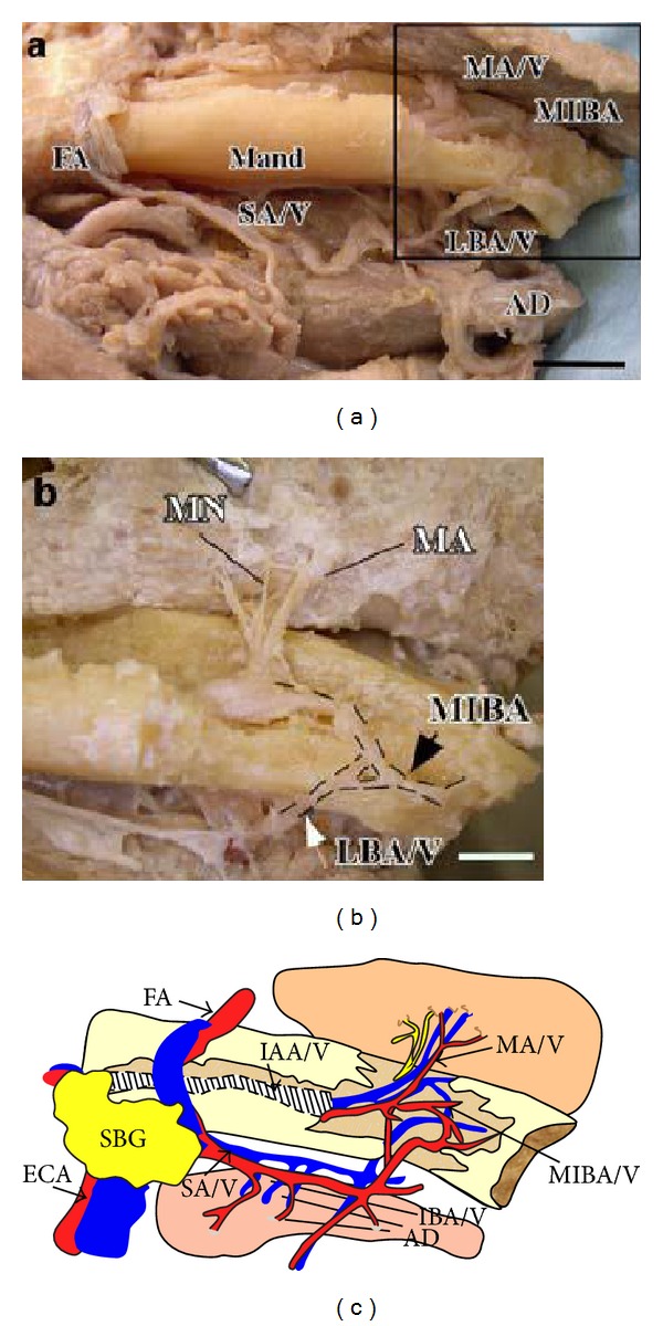 Anterior mandibular lingual foramina: an in vivo investigation.