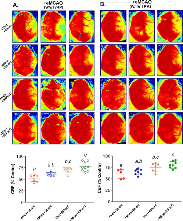 A 2 × 2 factorial design for the combination therapy of minocycline and remote ischemic perconditioning: efficacy in a preclinical trial in murine thromboembolic stroke model.