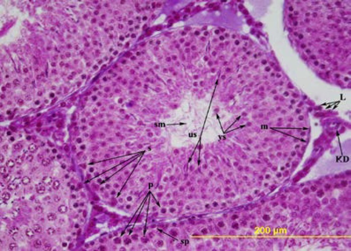 The effects of prepubertal epididymal ligation upon the rat testis.