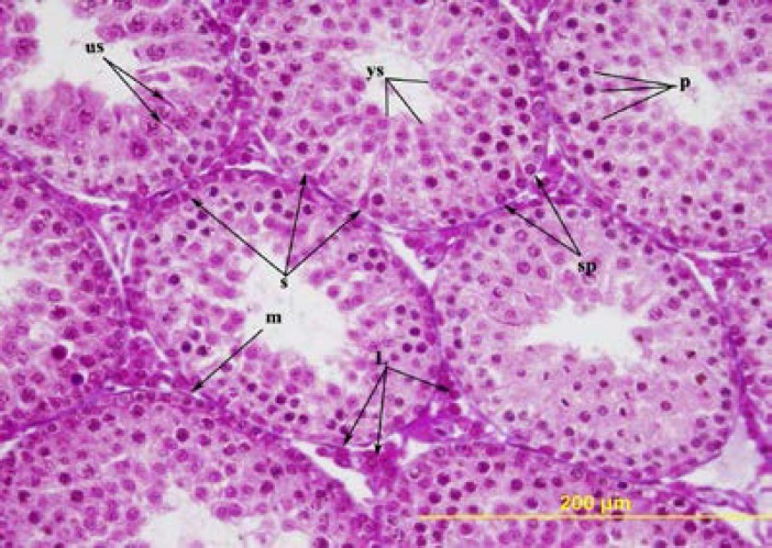 The effects of prepubertal epididymal ligation upon the rat testis.