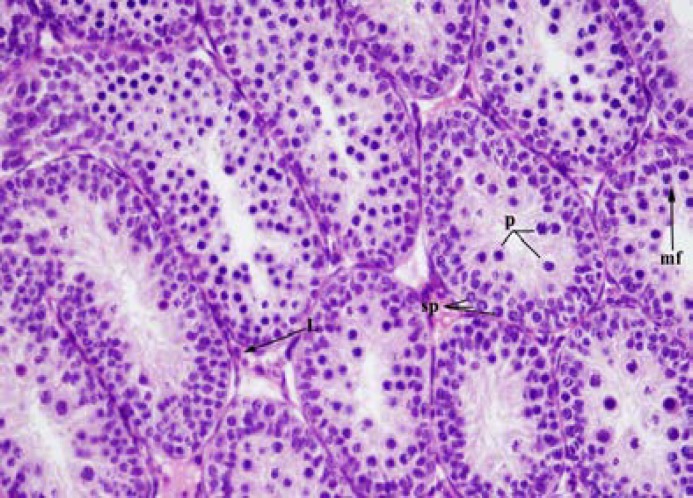 The effects of prepubertal epididymal ligation upon the rat testis.