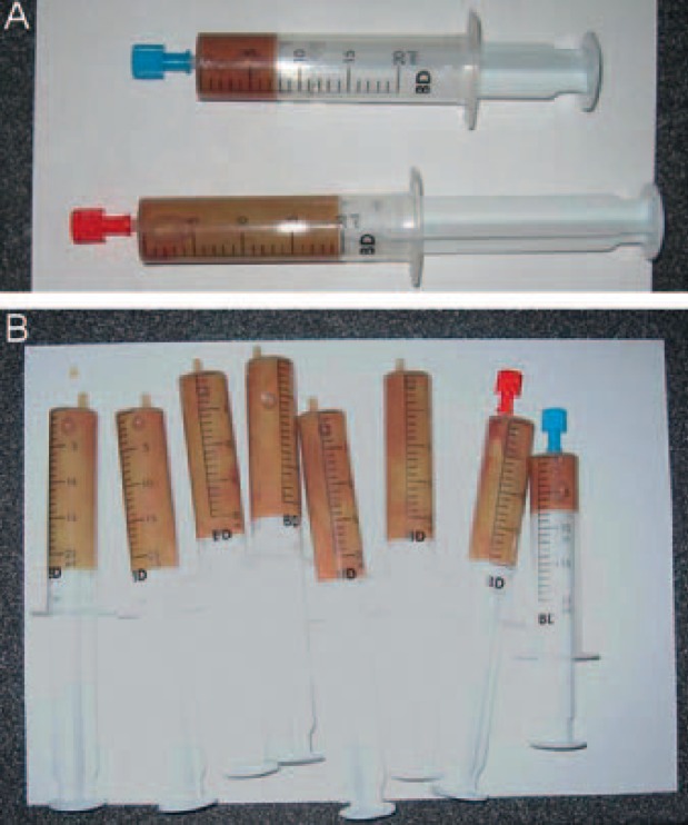 Therapy of Liver Abscesses.