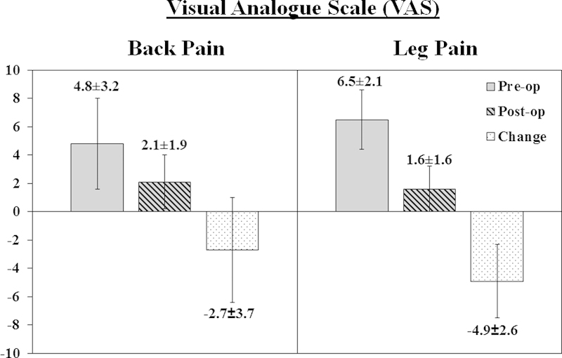 Microdiscectomy for the treatment of lumbar disc herniation: an evaluation of reoperations and long-term outcomes.