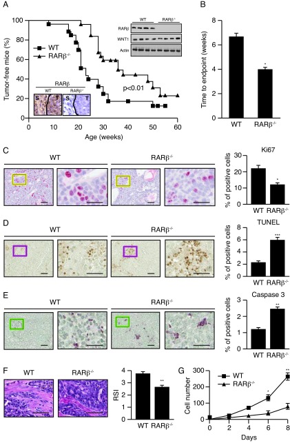 Inactivation of RARβ inhibits Wnt1-induced mammary tumorigenesis by suppressing epithelial-mesenchymal transitions.