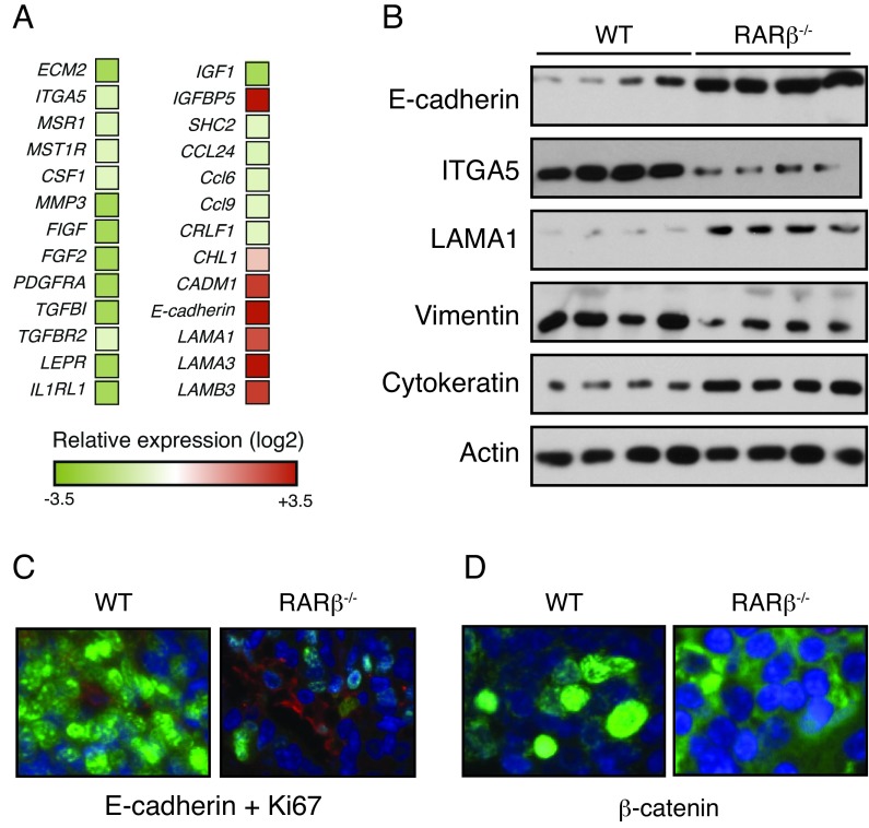 Inactivation of RARβ inhibits Wnt1-induced mammary tumorigenesis by suppressing epithelial-mesenchymal transitions.