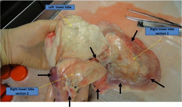 Multipotent adult progenitor cells decrease cold ischemic injury in ex vivo perfused human lungs: an initial pilot and feasibility study.