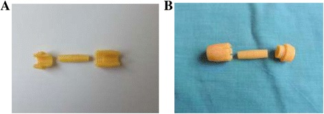 The vascular connector, design of a new device for sutureless vascular anastomosis.