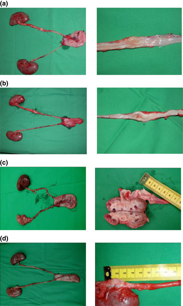 The feasibility of ureteral tissue engineering using autologous veins: an orthotopic animal model with long term results.