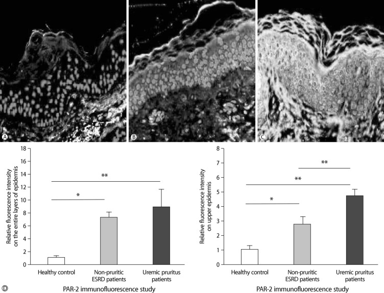 Epidermal Proteinase-Activated Receptor-2 Expression is Increased in End-Stage Renal Disease Patients with Pruritus: A Pilot Study.