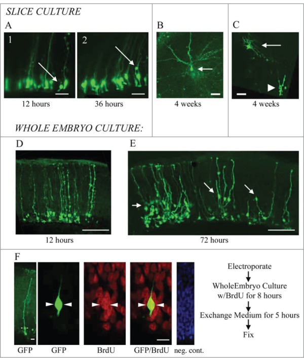 Radial glia in the proliferative ventricular zone of the embryonic and adult turtle, Trachemys scripta elegans.