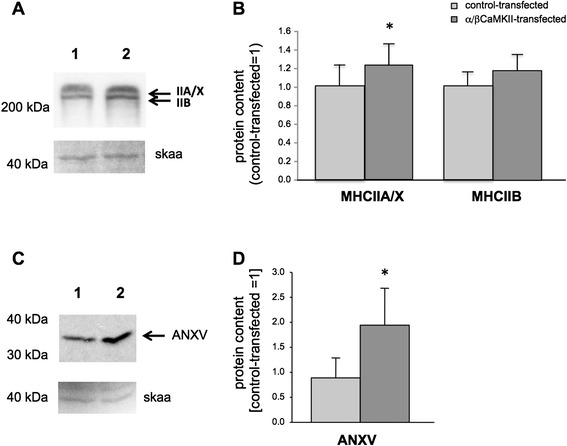 CaMKII content affects contractile, but not mitochondrial, characteristics in regenerating skeletal muscle.