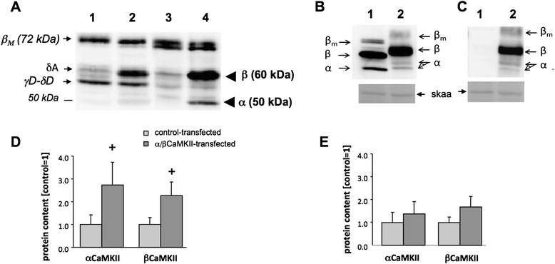 CaMKII content affects contractile, but not mitochondrial, characteristics in regenerating skeletal muscle.