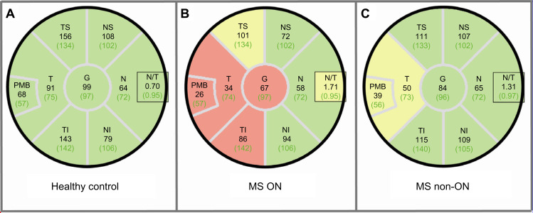 Optical coherence tomography for retinal imaging in multiple sclerosis.