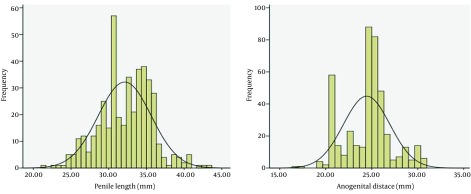 Penile length and anogenital distance in male newborns from different Iranian ethnicities in golestan province.