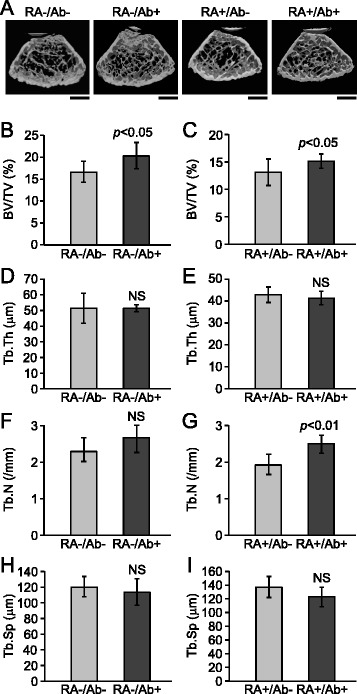 Effects of antibody to receptor activator of nuclear factor κ-B ligand on inflammation and cartilage degradation in collagen antibody-induced arthritis in mice.