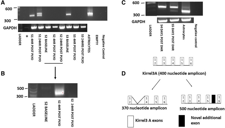 Identification of novel Kirrel3 gene splice variants in adult human skeletal muscle.