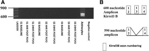 Identification of novel Kirrel3 gene splice variants in adult human skeletal muscle.