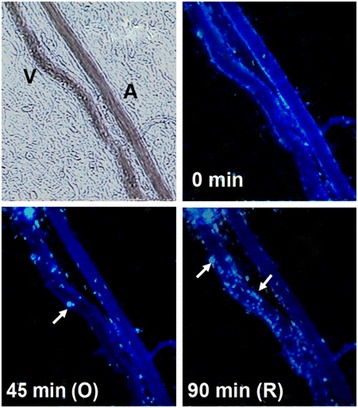 Cellular and molecular basis of Venous insufficiency.