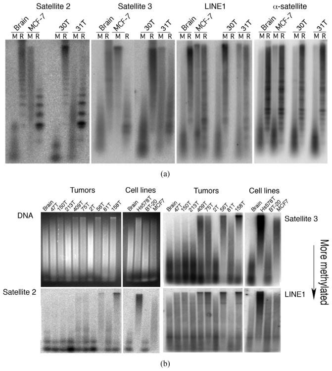 Methylation Abnormalities in Mammary Carcinoma: The Methylation Suicide Hypothesis.
