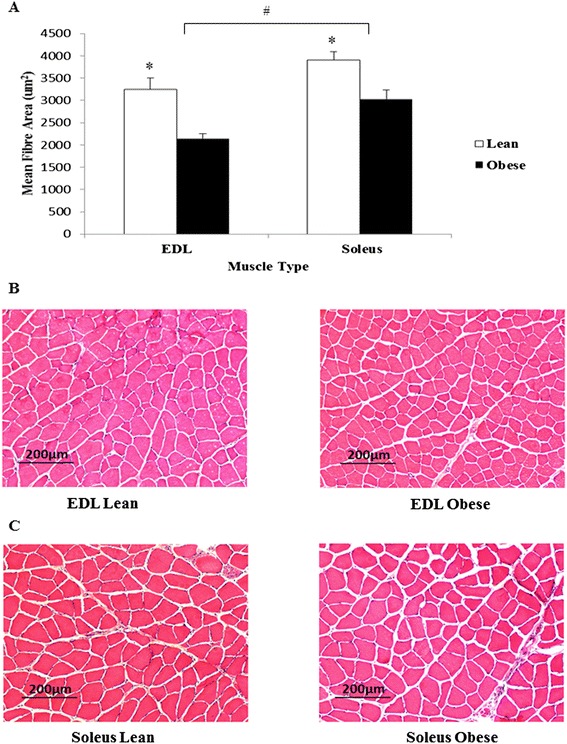 Skeletal muscle atrophy in sedentary Zucker obese rats is not caused by calpain-mediated muscle damage or lipid peroxidation induced by oxidative stress.