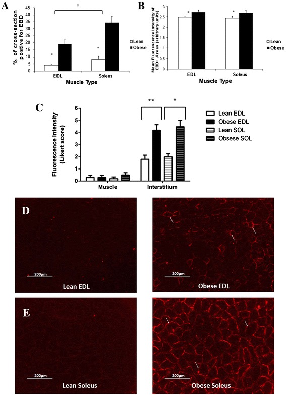 Skeletal muscle atrophy in sedentary Zucker obese rats is not caused by calpain-mediated muscle damage or lipid peroxidation induced by oxidative stress.