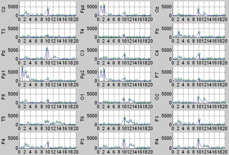 Study on bayes discriminant analysis of EEG data.