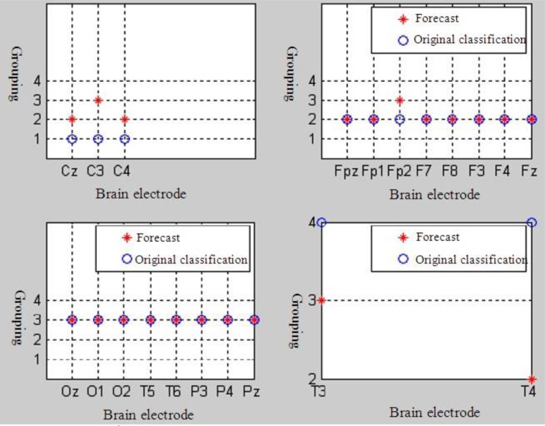 Study on bayes discriminant analysis of EEG data.