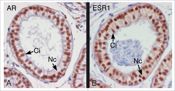 Disruption of estrogen receptor signaling and similar pathways in the efferent ductules and initial segment of the epididymis.