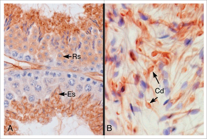 Disruption of estrogen receptor signaling and similar pathways in the efferent ductules and initial segment of the epididymis.